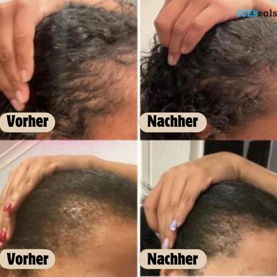 Natural hair growth oil (Now buy 1+1 free!)
